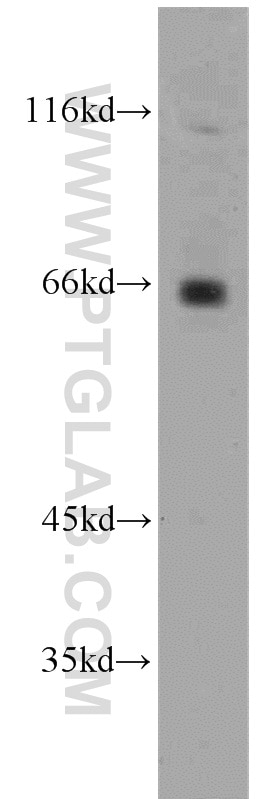 Western Blot (WB) analysis of human brain tissue using ZNF74 Polyclonal antibody (21843-1-AP)