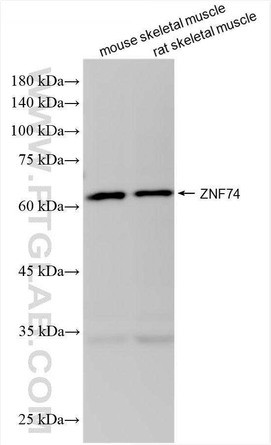 Western Blot (WB) analysis of various lysates using ZNF74 Recombinant antibody (86065-1-RR)