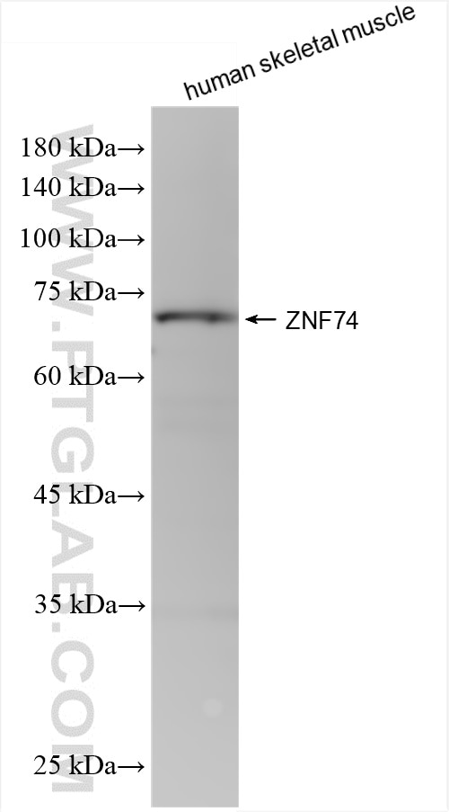 Western Blot (WB) analysis of various lysates using ZNF74 Recombinant antibody (86065-1-RR)