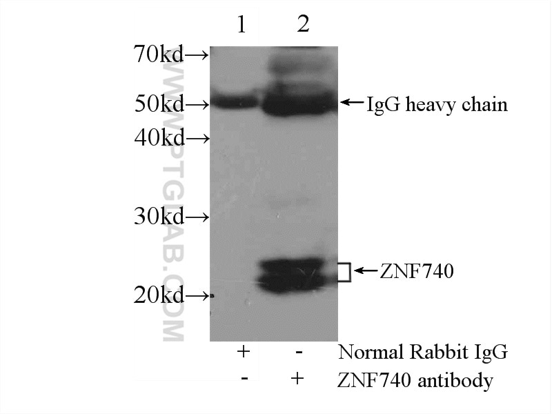Immunoprecipitation (IP) experiment of mouse brain tissue using ZNF740 Polyclonal antibody (25411-1-AP)
