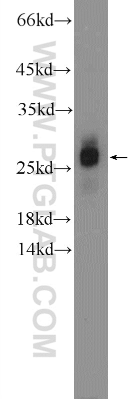 Western Blot (WB) analysis of mouse brain tissue using ZNF740 Polyclonal antibody (25411-1-AP)