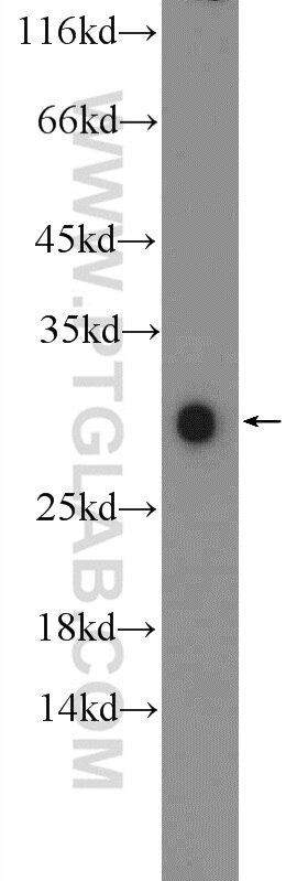 Western Blot (WB) analysis of PC-3 cells using ZNF740 Polyclonal antibody (25411-1-AP)