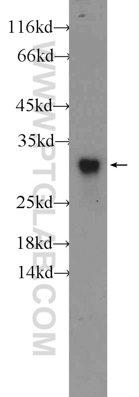 Western Blot (WB) analysis of mouse liver tissue using ZNF740 Polyclonal antibody (25411-1-AP)
