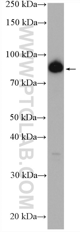 Western Blot (WB) analysis of HEK-293T cells using ZNF746 Polyclonal antibody (24543-1-AP)