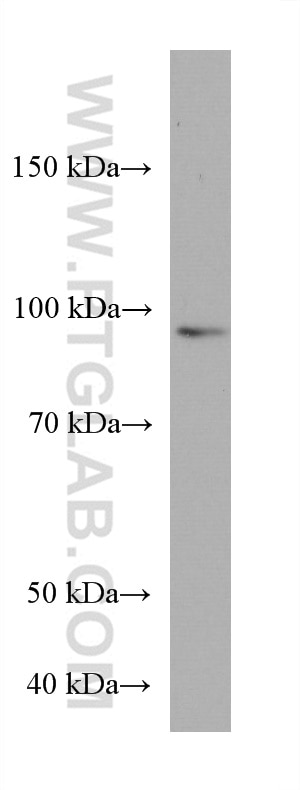 Western Blot (WB) analysis of LNCaP cells using ZNF746 Monoclonal antibody (67463-1-Ig)