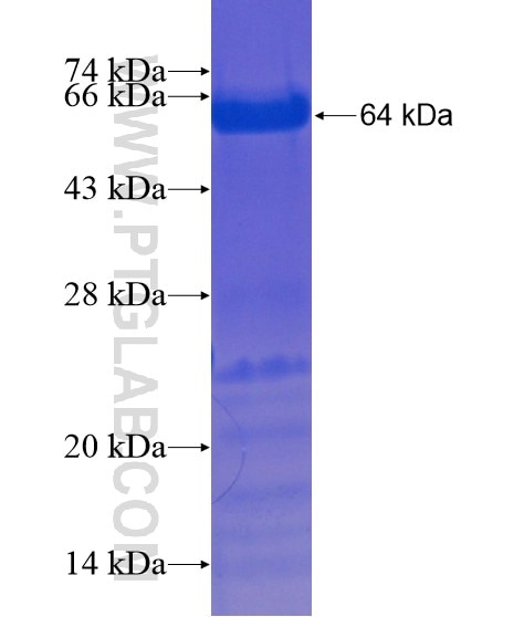 ZNF746 fusion protein Ag21582 SDS-PAGE