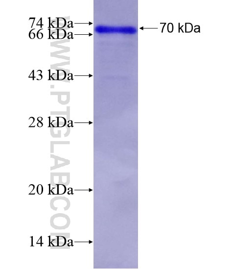 ZNF746 fusion protein Ag21566 SDS-PAGE