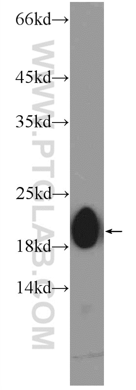 Western Blot (WB) analysis of PC-3 cells using ZNF747 Polyclonal antibody (19901-1-AP)