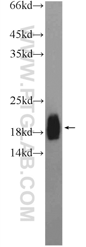 Western Blot (WB) analysis of PC-3 cells using ZNF747 Polyclonal antibody (19901-1-AP)