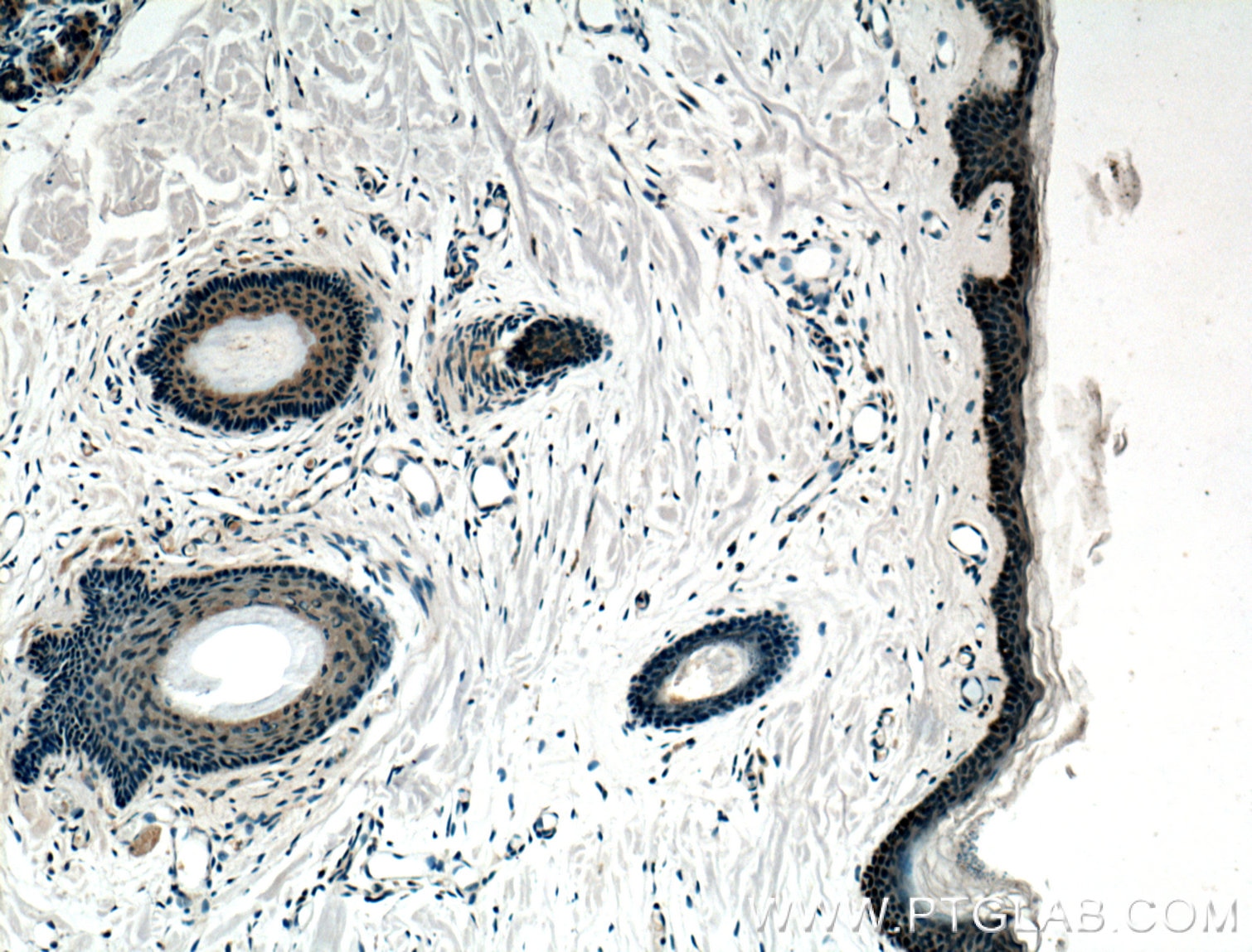 Immunohistochemistry (IHC) staining of human skin tissue using ZNF750 Polyclonal antibody (21752-1-AP)