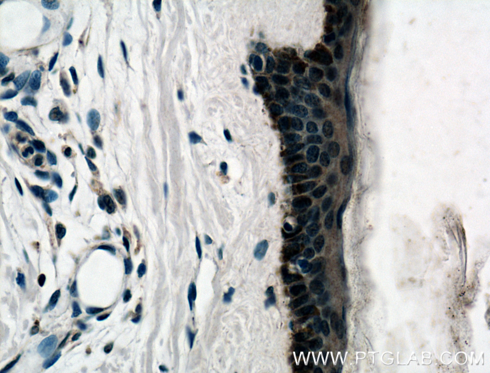 Immunohistochemistry (IHC) staining of human skin tissue using ZNF750 Polyclonal antibody (21752-1-AP)