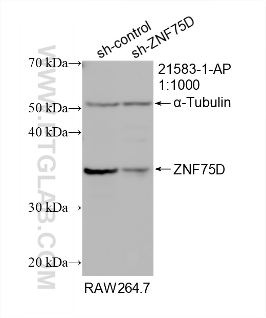 Western Blot (WB) analysis of RAW 264.7 cells using ZNF75D Polyclonal antibody (21583-1-AP)