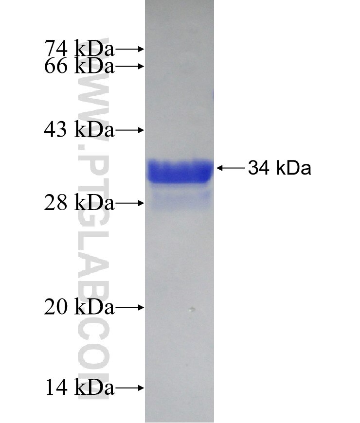 ZNF75D fusion protein Ag16139 SDS-PAGE