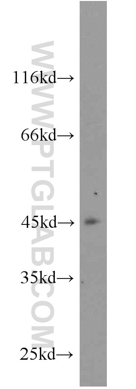 Western Blot (WB) analysis of MCF-7 cells using ZNF763 Polyclonal antibody (21922-1-AP)