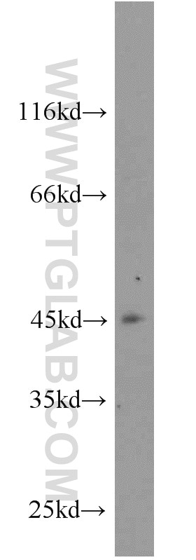 Western Blot (WB) analysis of MCF-7 cells using ZNF763 Polyclonal antibody (21922-1-AP)