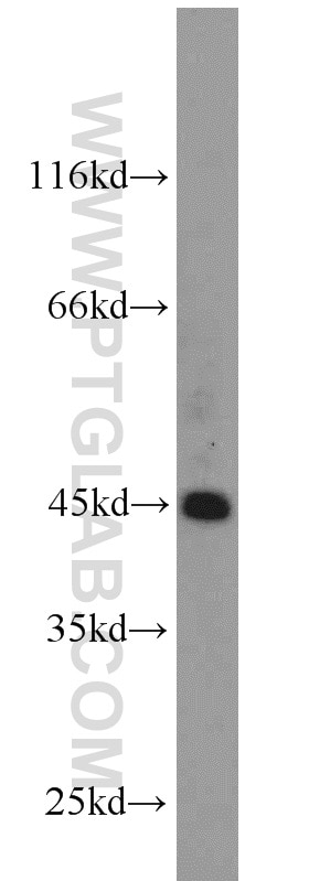Western Blot (WB) analysis of HeLa cells using ZNF763 Polyclonal antibody (21922-1-AP)