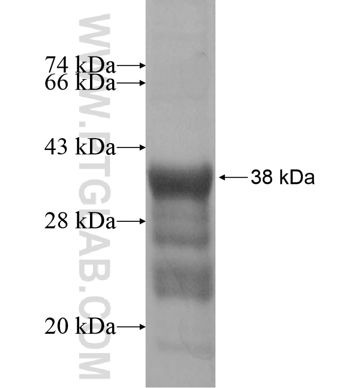 ZNF763 fusion protein Ag16440 SDS-PAGE