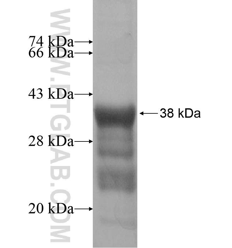 ZNF763 fusion protein Ag16440 SDS-PAGE