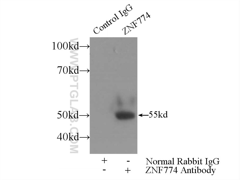 Immunoprecipitation (IP) experiment of HepG2 cells using ZNF774 Polyclonal antibody (25449-1-AP)