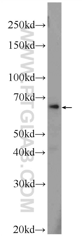 Western Blot (WB) analysis of HepG2 cells using ZNF774 Polyclonal antibody (25449-1-AP)