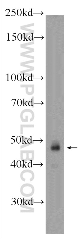 Western Blot (WB) analysis of HeLa cells using ZNF785 Polyclonal antibody (25588-1-AP)