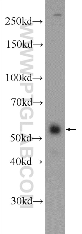 Western Blot (WB) analysis of A549 cells using ZNF785 Polyclonal antibody (25588-1-AP)