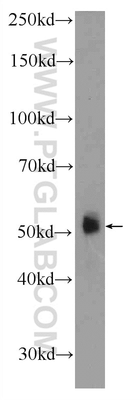 Western Blot (WB) analysis of PC-3 cells using ZNF785 Polyclonal antibody (25588-1-AP)