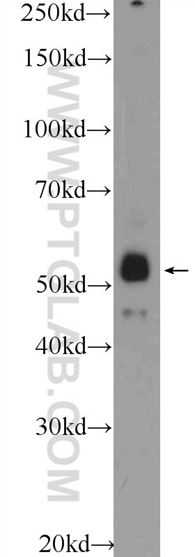 Western Blot (WB) analysis of HeLa cells using ZNF785 Polyclonal antibody (25588-1-AP)