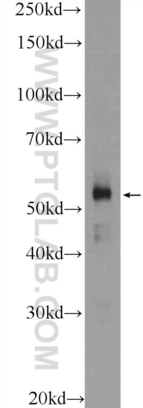 Western Blot (WB) analysis of A549 cells using ZNF785 Polyclonal antibody (25588-1-AP)