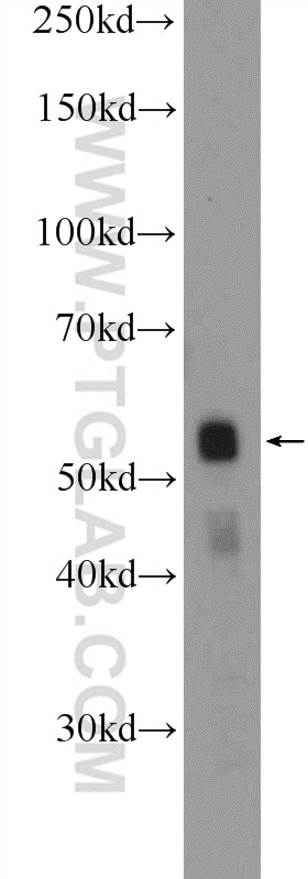 Western Blot (WB) analysis of HepG2 cells using ZNF785 Polyclonal antibody (25588-1-AP)