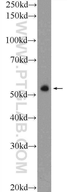 Western Blot (WB) analysis of HepG2 cells using ZNF785 Polyclonal antibody (25588-1-AP)