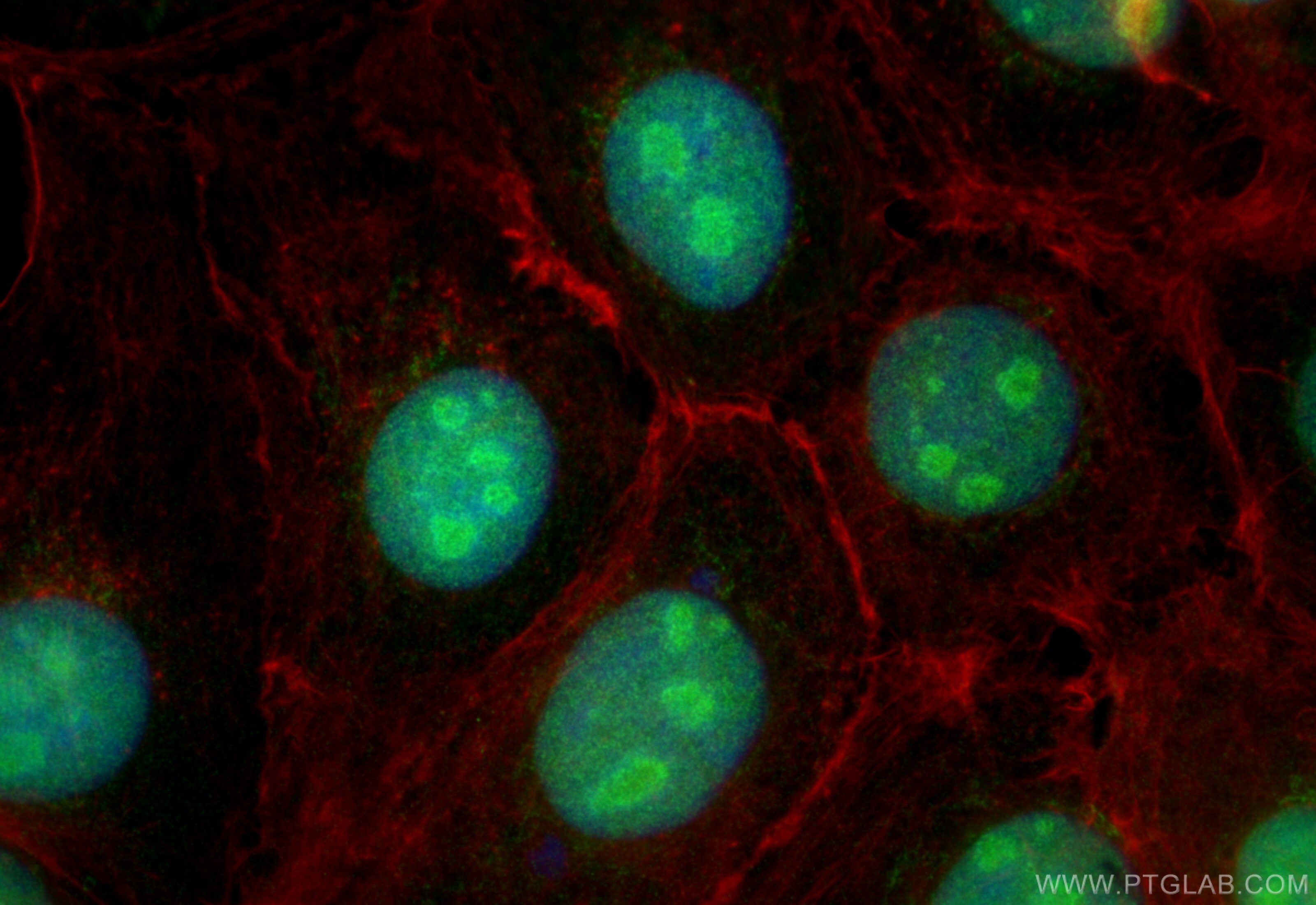 Immunofluorescence (IF) / fluorescent staining of A431 cells using ZNF787 Polyclonal antibody (31934-1-AP)