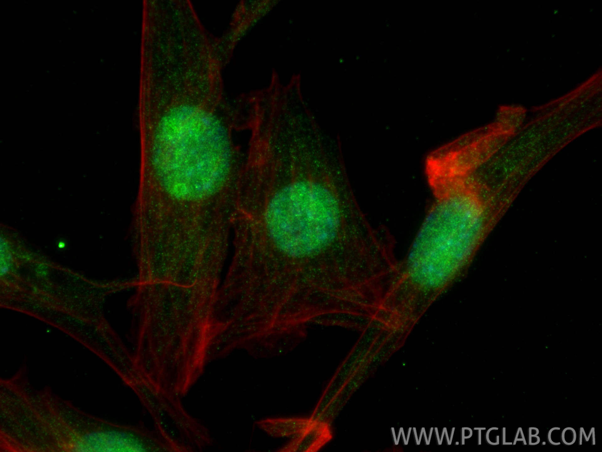 IF Staining of NIH/3T3 using 33930-1-AP Immunofluorescence (IF) / fluorescent staining of NIH/3T3 cells using ZNF800 Polyclonal antibody (33930-1-AP)