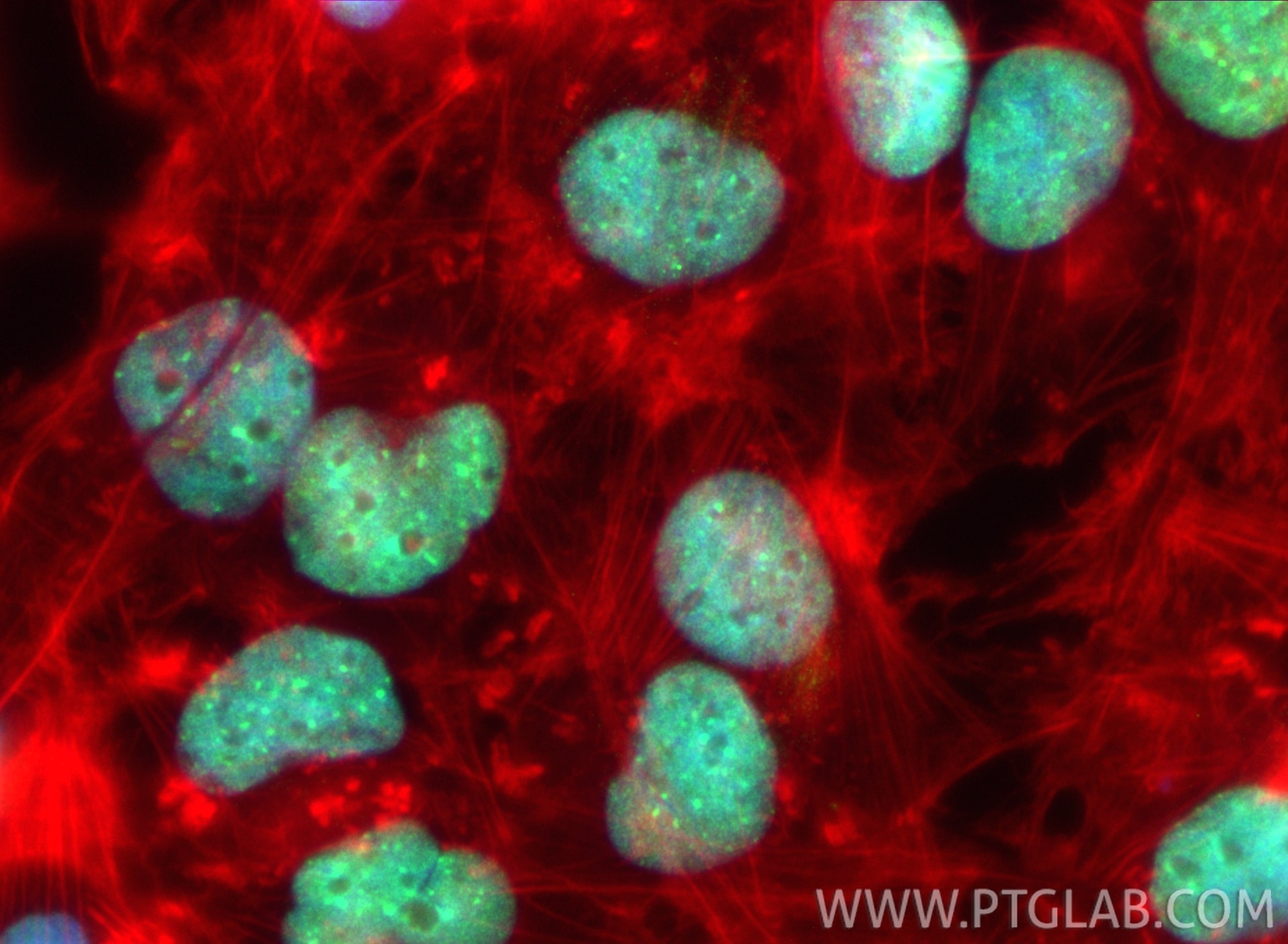 Immunofluorescence (IF) / fluorescent staining of U-251 cells using ZNF816 Polyclonal antibody (21221-1-AP)