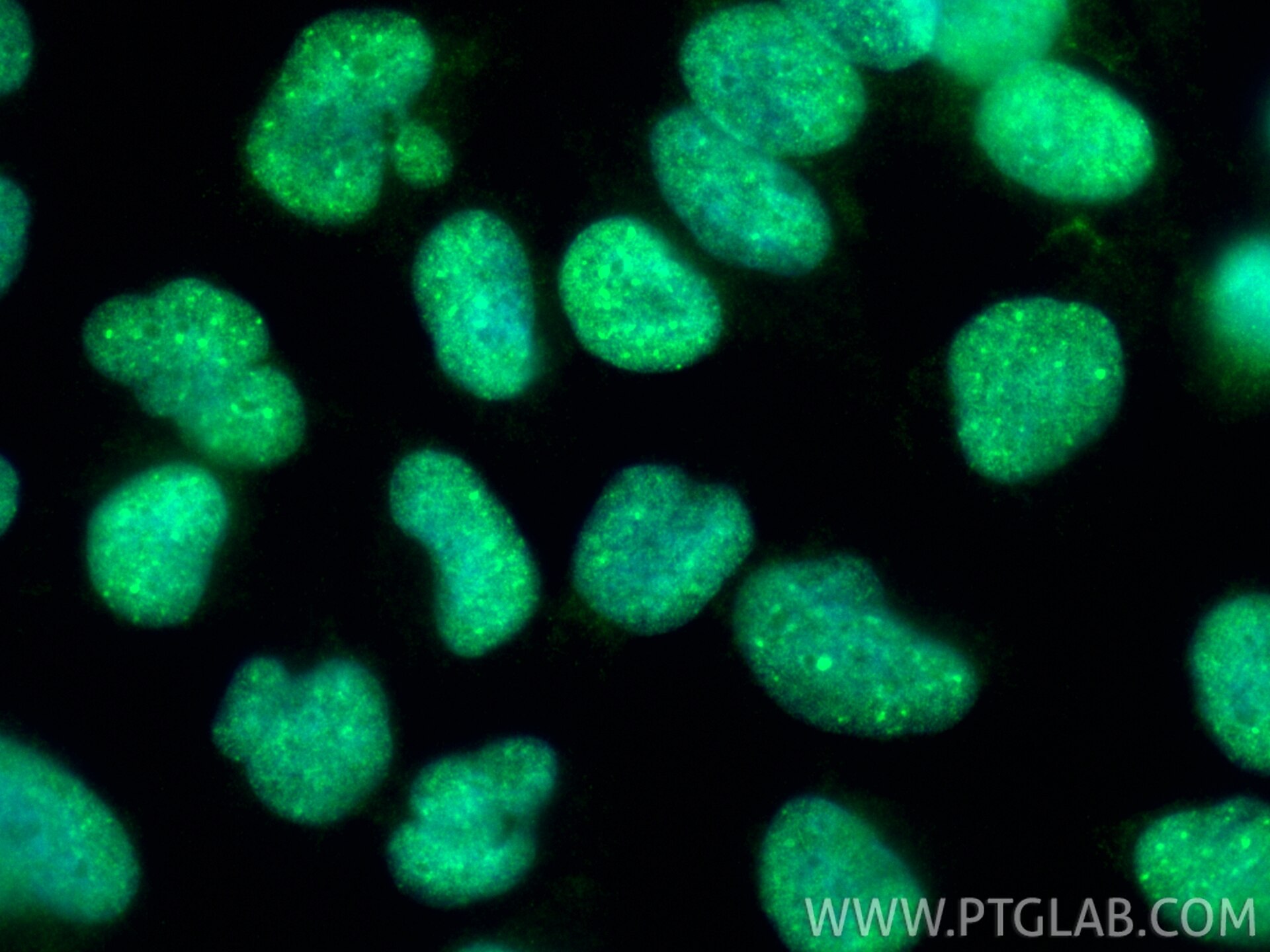 Immunofluorescence (IF) / fluorescent staining of U-251 cells using ZNF816 Polyclonal antibody (21221-1-AP)