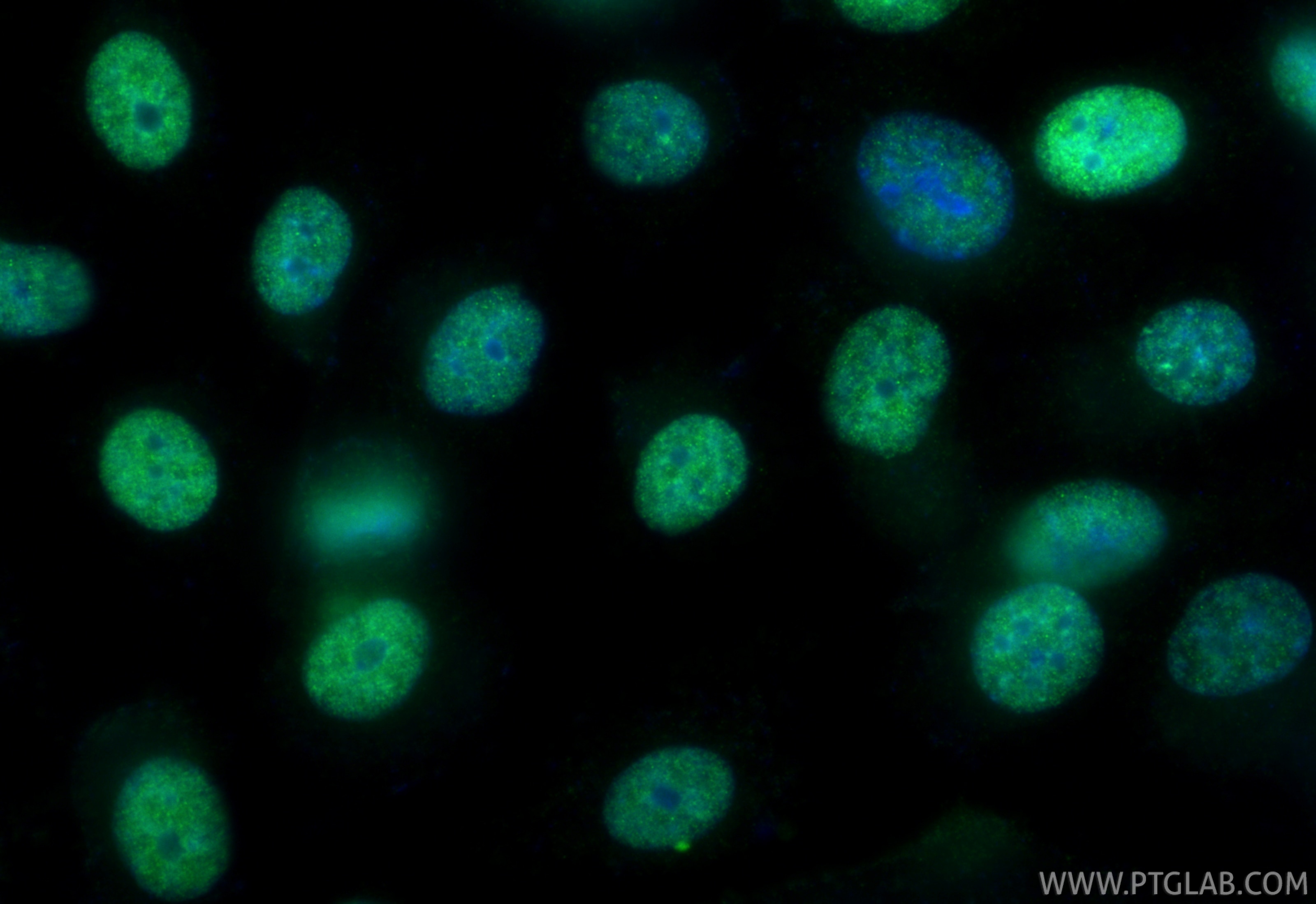 IF Staining of PC-3 using 21221-1-AP (same clone as 21221-1-PBS) Immunofluorescence (IF) / fluorescent staining of PC-3 cells using ZNF816 Polyclonal antibody (21221-1-AP)