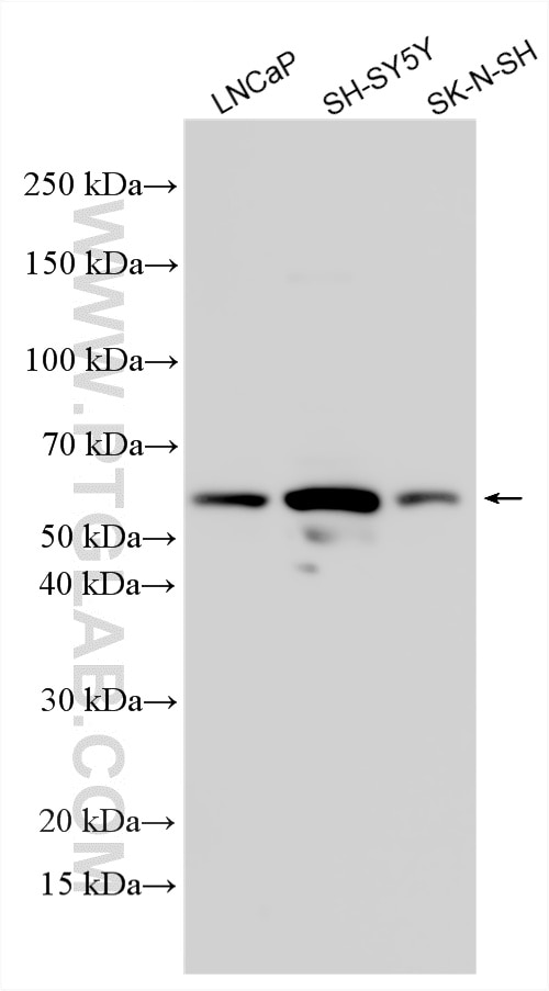 Western Blot (WB) analysis of various lysates using ZNF821 Polyclonal antibody (33351-1-AP)