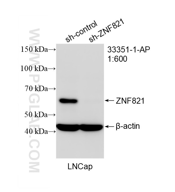 Western Blot (WB) analysis of LNCaP cells using ZNF821 Polyclonal antibody (33351-1-AP)