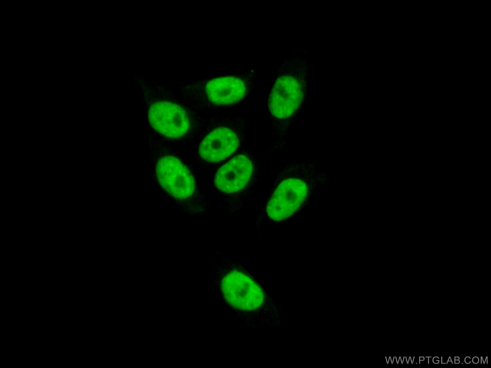 Immunofluorescence (IF) / fluorescent staining of HeLa cells using ZNF828 Polyclonal antibody (26315-1-AP)