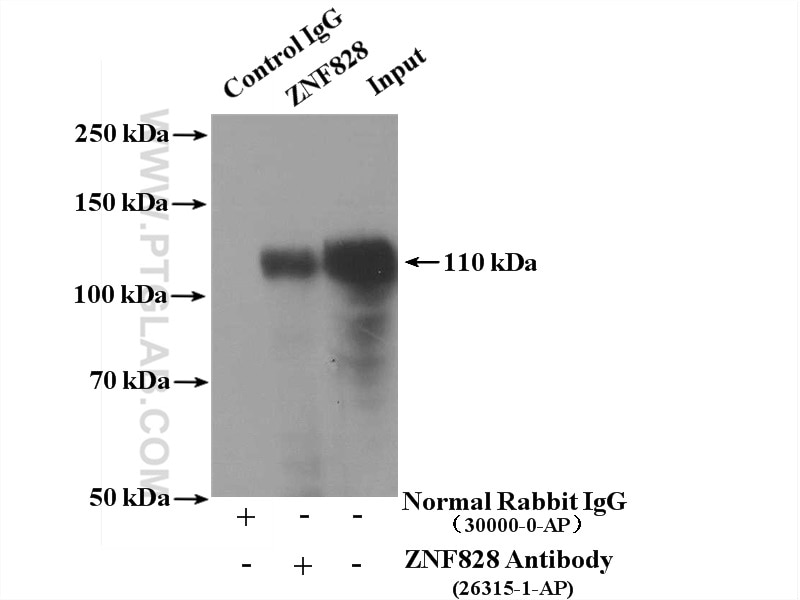Immunoprecipitation (IP) experiment of Jurkat cells using ZNF828 Polyclonal antibody (26315-1-AP)