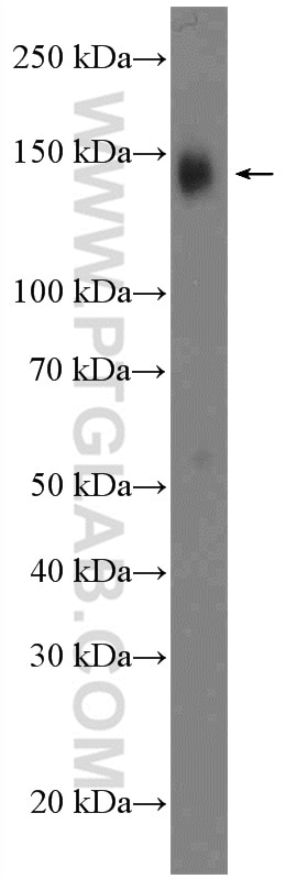 Western Blot (WB) analysis of Jurkat cells using ZNF828 Polyclonal antibody (26315-1-AP)