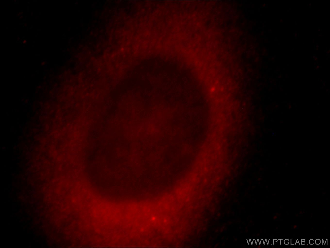 Immunofluorescence (IF) / fluorescent staining of HeLa cells using ZNF839 Polyclonal antibody (20539-1-AP)