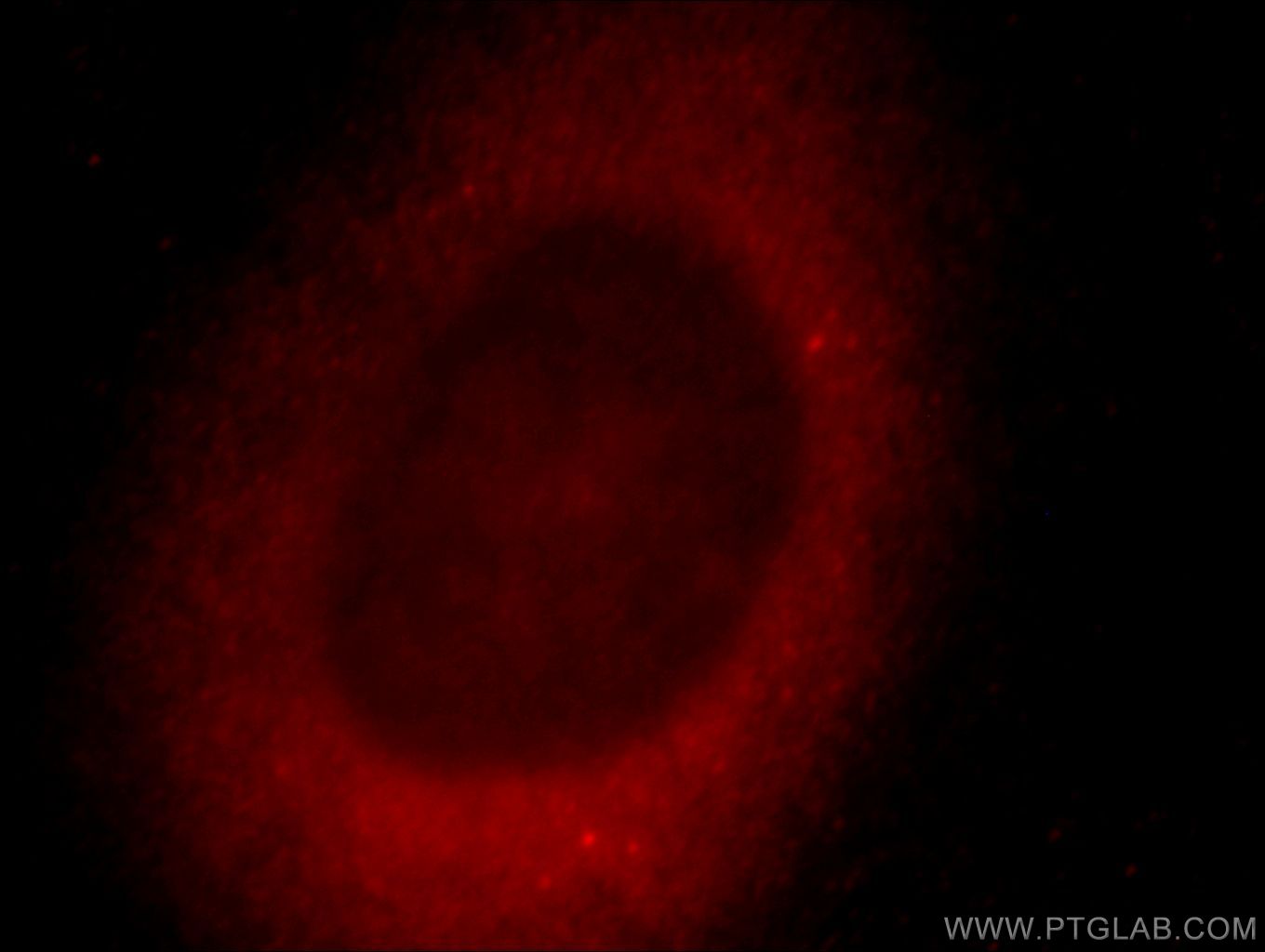 IF Staining of HeLa using 20539-1-AP