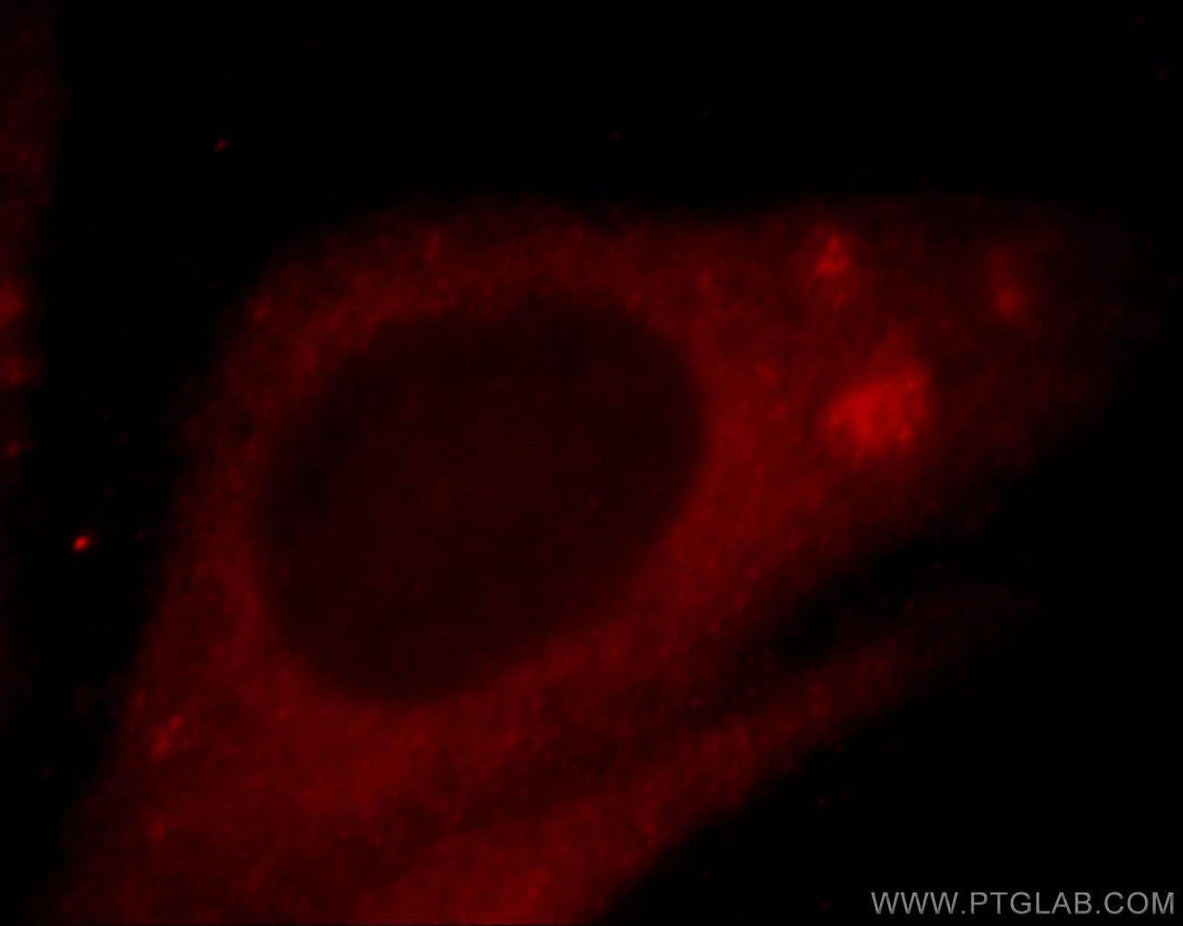 Immunofluorescence (IF) / fluorescent staining of HepG2 cells using ZNF839 Polyclonal antibody (20539-1-AP)