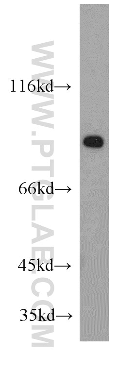 Western Blot (WB) analysis of HeLa cells using ZNF839 Polyclonal antibody (20539-1-AP)