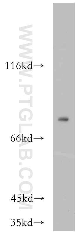 WB analysis of human small intestine using 20539-1-AP