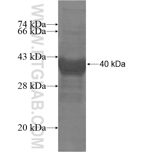 ZNF839 fusion protein Ag14573 SDS-PAGE