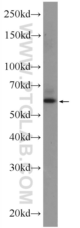 Western Blot (WB) analysis of C6 cells using ZNF846 Polyclonal antibody (24514-1-AP)