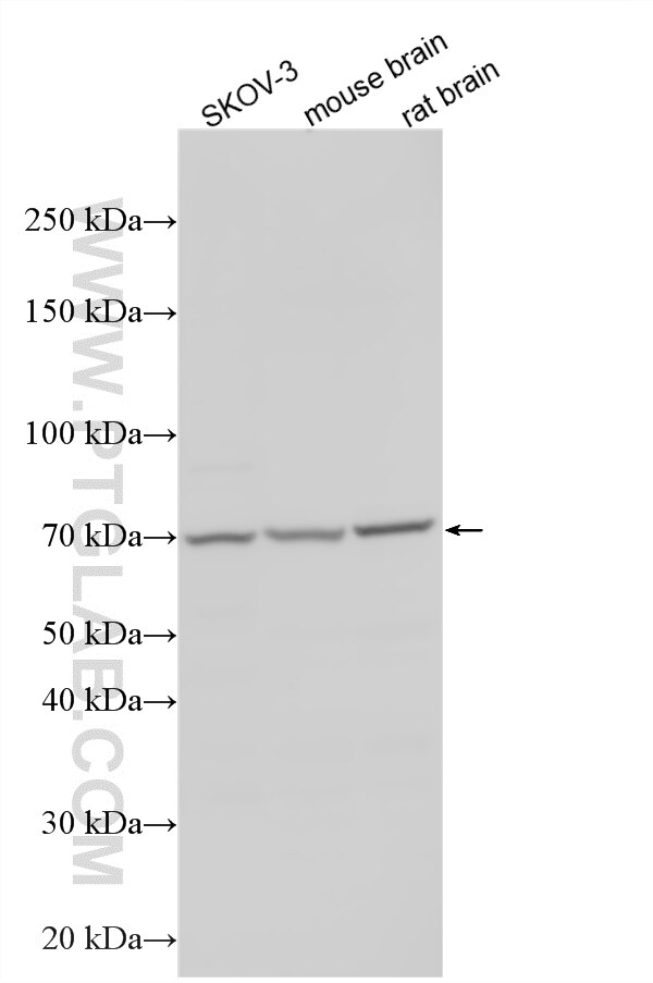 WB analysis using 33448-1-AP Western Blot (WB) analysis of various lysates using ZNF85 Polyclonal antibody (33448-1-AP)
