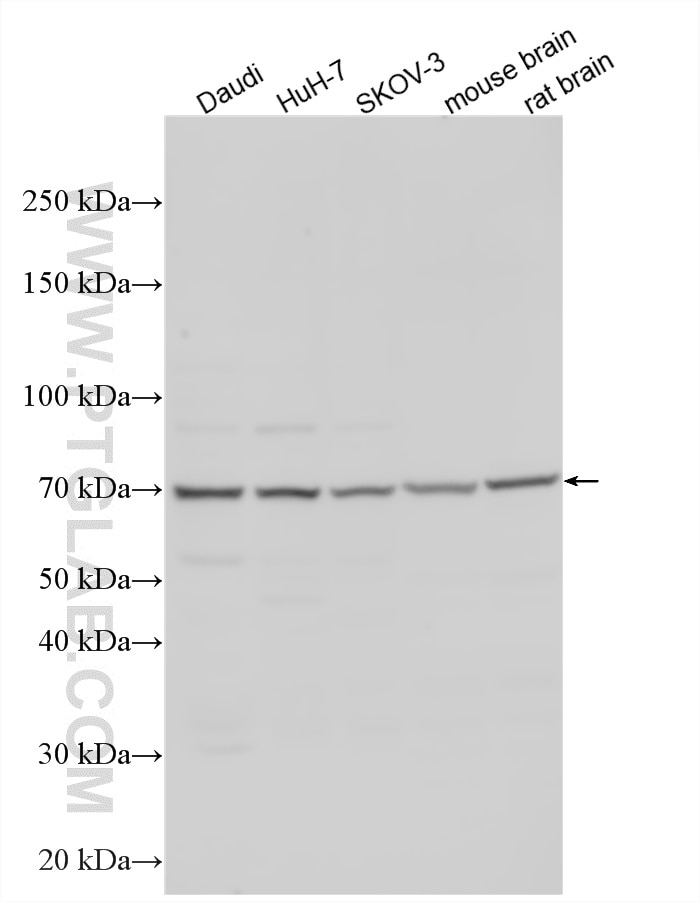 WB analysis using 33448-1-AP Western Blot (WB) analysis of various lysates using ZNF85 Polyclonal antibody (33448-1-AP)